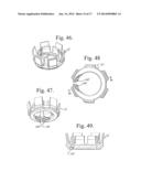 POLYAXIAL BONE ANCHOR WITH POP-ON SHANK, FRICTION FIT RETAINER, WINGED     INSERT AND LOW PROFILE EDGE LOCK diagram and image