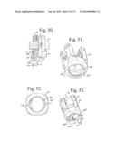 POLYAXIAL BONE ANCHOR WITH POP-ON SHANK, FRICTION FIT RETAINER, WINGED     INSERT AND LOW PROFILE EDGE LOCK diagram and image