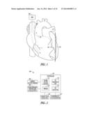 ADAPTIVE PHRENIC NERVE STIMULATION DETECTION diagram and image