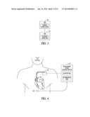 ADAPTIVE PHRENIC NERVE STIMULATION DETECTION diagram and image