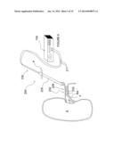 Apparatuses for Renal Neuromodulation diagram and image