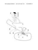 Apparatuses for Renal Neuromodulation diagram and image