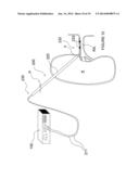 Apparatuses for Renal Neuromodulation diagram and image