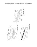 Apparatuses for Renal Neuromodulation diagram and image