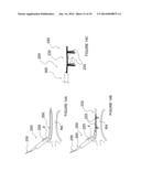 Apparatuses for Renal Neuromodulation diagram and image