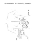 Apparatuses for Renal Neuromodulation diagram and image