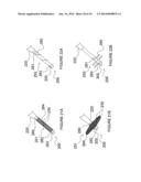 Apparatuses for Renal Neuromodulation diagram and image