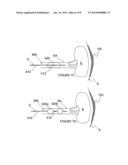 METHODS FOR MONOPOLAR RENAL NEUROMODULATION diagram and image