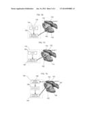 BRAIN REPAIR USING ELECTRICAL STIMULATION OF HEALTHY NODES diagram and image