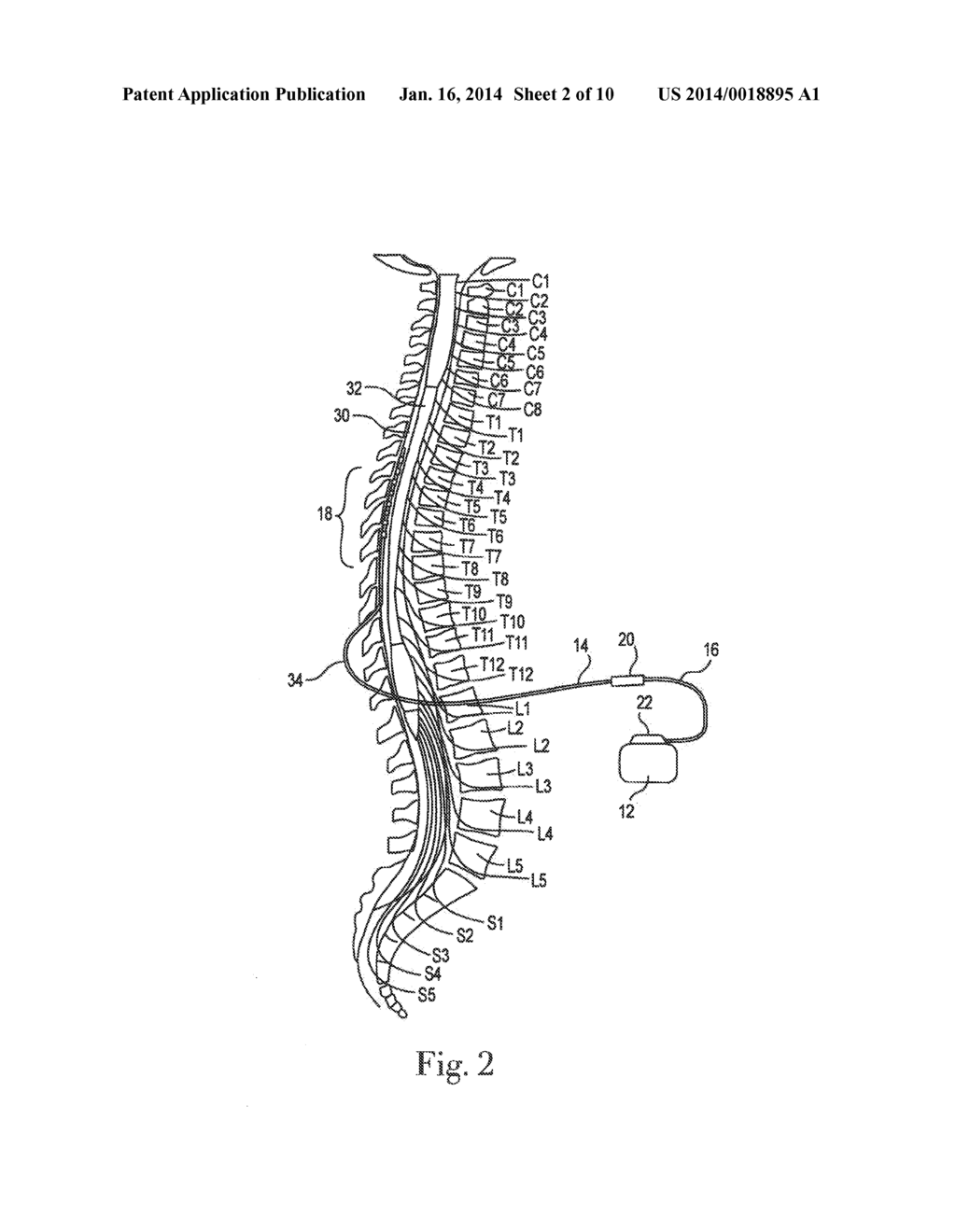 LEAD BODY WITH INNER AND OUTER CO-AXIAL COILS - diagram, schematic, and image 03