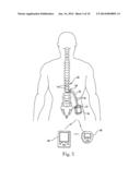 LEAD BODY WITH INNER AND OUTER CO-AXIAL COILS diagram and image