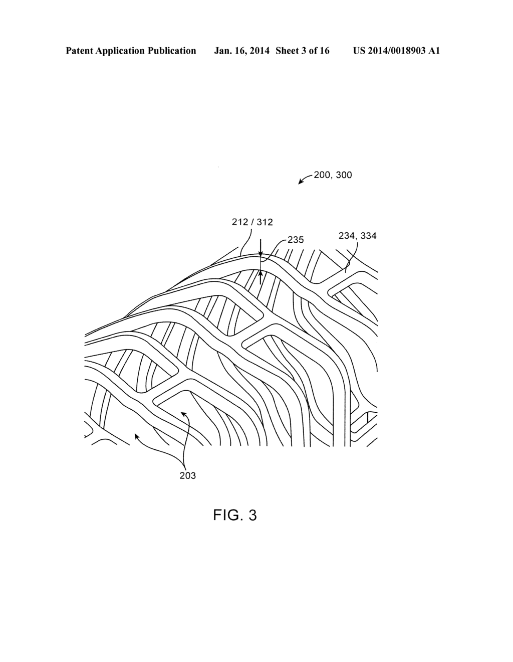 POLYMER SCAFFOLDS FOR PERIPHERAL VESSELS - diagram, schematic, and image 04