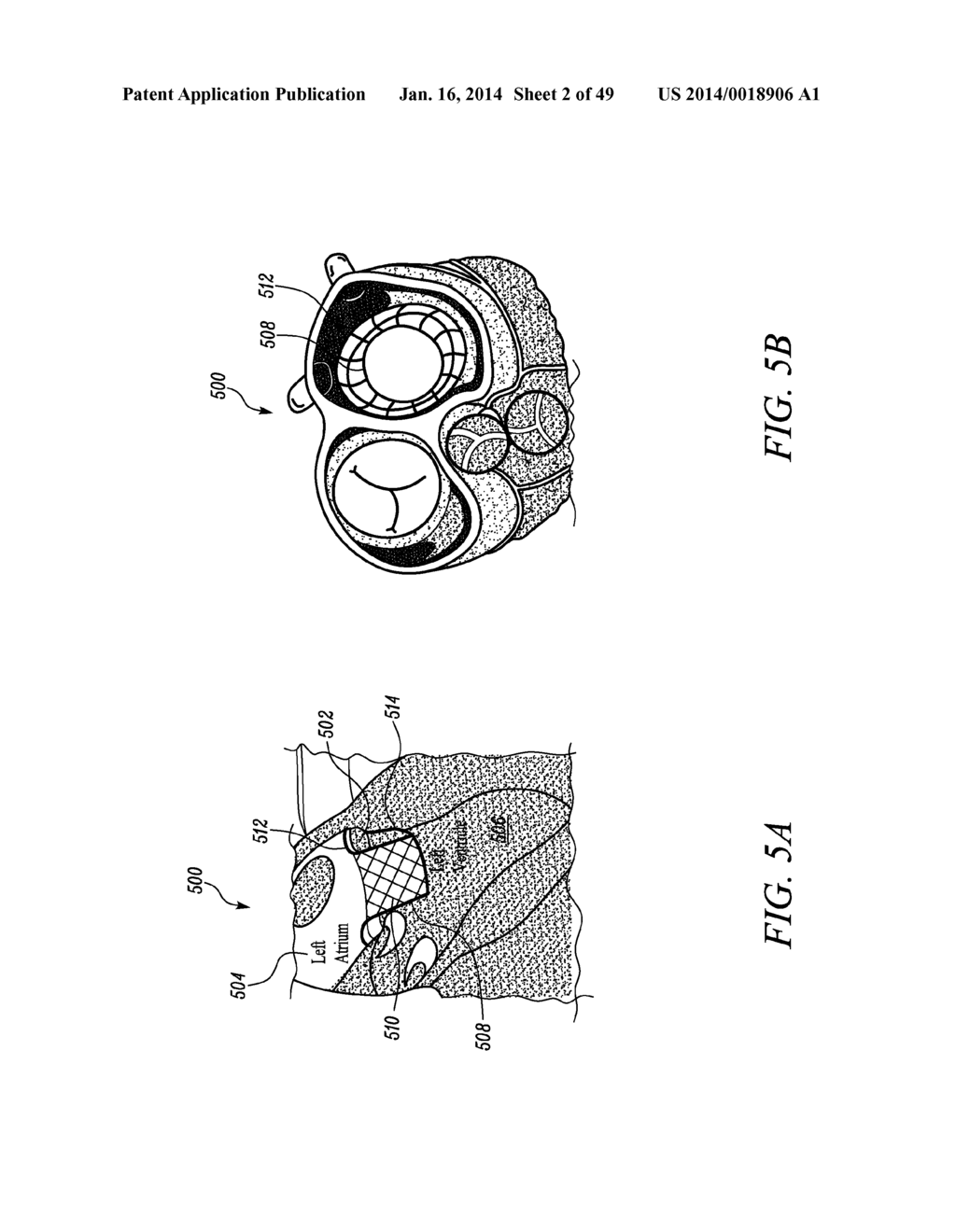 METHODS AND SYSTEMS FOR DELIVERING PROSTHESES USING RAIL TECHNIQUES - diagram, schematic, and image 03