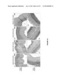 Treatment to Render Implants Resistant to Diabetes diagram and image