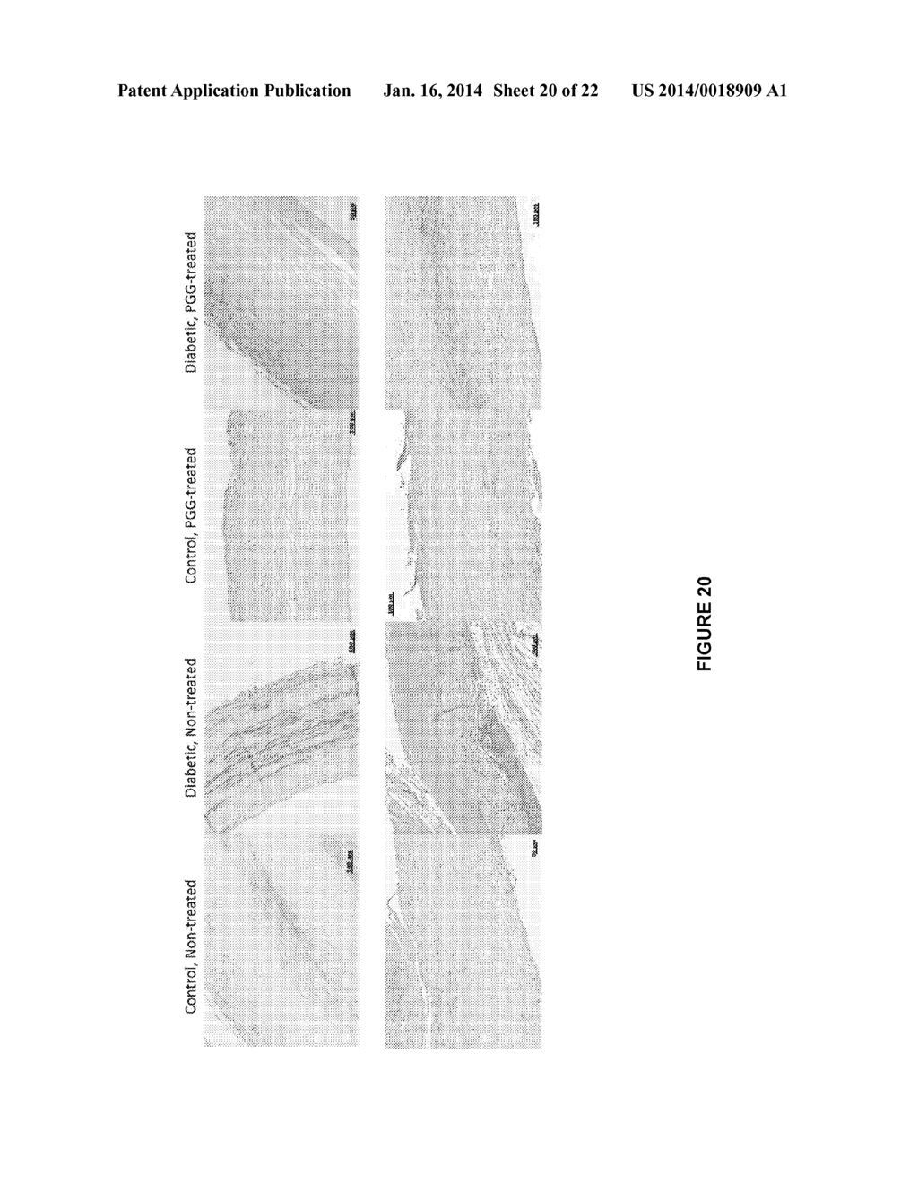 Treatment to Render Implants Resistant to Diabetes - diagram, schematic, and image 21