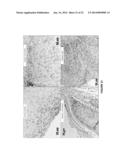 Treatment to Render Implants Resistant to Diabetes diagram and image