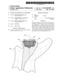 Revision Glenoid Device and Method diagram and image