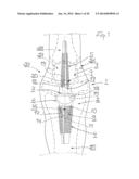 PROSTHESIS FOR ARTHRODHESIS diagram and image