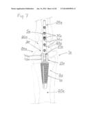 PROSTHESIS FOR ARTHRODHESIS diagram and image