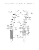 PROSTHESIS FOR ARTHRODHESIS diagram and image