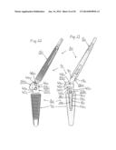 PROSTHESIS FOR ARTHRODHESIS diagram and image