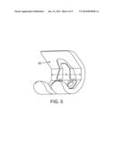 Pre-Operative Planning And Manufacturing Method For Orthopedic Procedure diagram and image