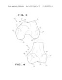 OPERATIVELY TUNING IMPLANTS FOR INCREASED PERFORMANCE diagram and image