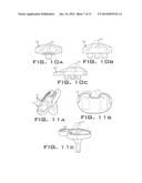 OPERATIVELY TUNING IMPLANTS FOR INCREASED PERFORMANCE diagram and image