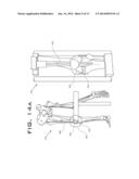 OPERATIVELY TUNING IMPLANTS FOR INCREASED PERFORMANCE diagram and image