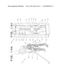 OPERATIVELY TUNING IMPLANTS FOR INCREASED PERFORMANCE diagram and image