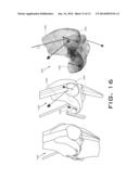 OPERATIVELY TUNING IMPLANTS FOR INCREASED PERFORMANCE diagram and image