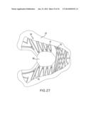 Footwear Assembly Method With 3D Printing diagram and image