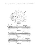 BONDED PATCH HAVING MULTIPLE ZONES OF FRACTURE TOUGHNESS diagram and image