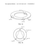 EDGE EXCLUSION CONTROL WITH ADJUSTABLE PLASMA EXCLUSION ZONE RING diagram and image