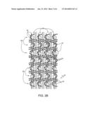 Filtration Article With Fluoropolymer Knit diagram and image