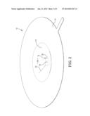 RUPTURE DISC HAVING LASER-DEFINED REVERSAL INITIATION AND DEFORMATION     CONTROL FEATURES diagram and image