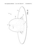 RUPTURE DISC HAVING LASER-DEFINED REVERSAL INITIATION AND DEFORMATION     CONTROL FEATURES diagram and image