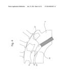 ROTOR diagram and image