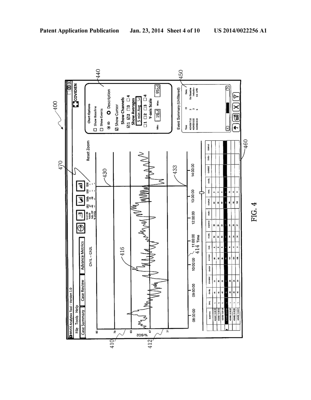 TIME ALIGNMENT DISPLAY TECHNIQUE FOR A MEDICAL DEVICE - diagram, schematic, and image 05