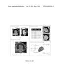 NON-INVASIVE METHODS AND SYSTEMS FOR PRODUCING CARDIAC ELECTROGRAM     CHARACTERISTIC MAPS FOR USE WITH CATHETER ABLATION OF VENTRICULAR     TACHYCARDIA diagram and image