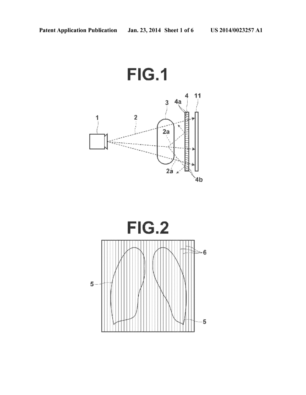 IMAGE PROCESSING APPARATUS, IMAGE PROCESSING METHOD AND IMAGE PROCESSING     PROGRAM - diagram, schematic, and image 02