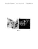 DECELLULARIZED LIVER TRANSPLANTATION COMPOSITION AND METHODS diagram and image