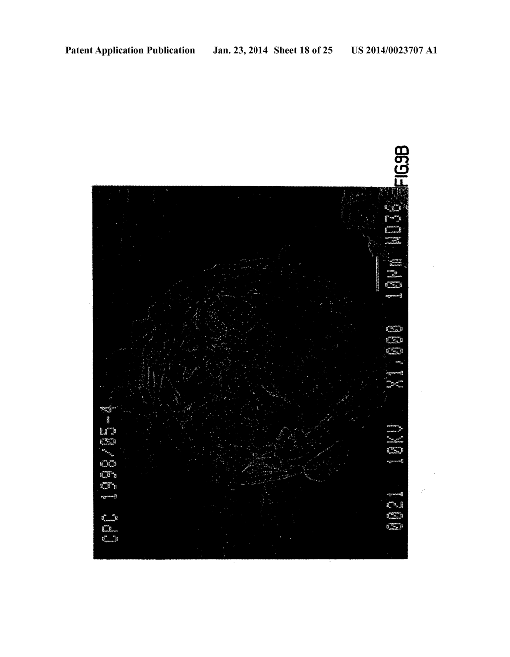 Co-Processed Carbohydrate System as a Quick-Dissolve Matrix for Solid     Dosage Forms - diagram, schematic, and image 19