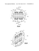 ADDRESSABLE MATRICES/CLUSTER BLANKS FOR DENTAL CAD/CAM SYSTEMS AND     OPTIMIZATION THEREOF diagram and image