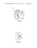 Orthodontic Bracket diagram and image