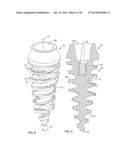 SELF-OSTEOTOMIZING BONE IMPLANT AND RELATED METHOD diagram and image