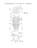 SELF-OSTEOTOMIZING BONE IMPLANT AND RELATED METHOD diagram and image