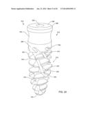 SELF-OSTEOTOMIZING BONE IMPLANT AND RELATED METHOD diagram and image