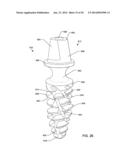 SELF-OSTEOTOMIZING BONE IMPLANT AND RELATED METHOD diagram and image