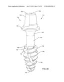 SELF-OSTEOTOMIZING BONE IMPLANT AND RELATED METHOD diagram and image